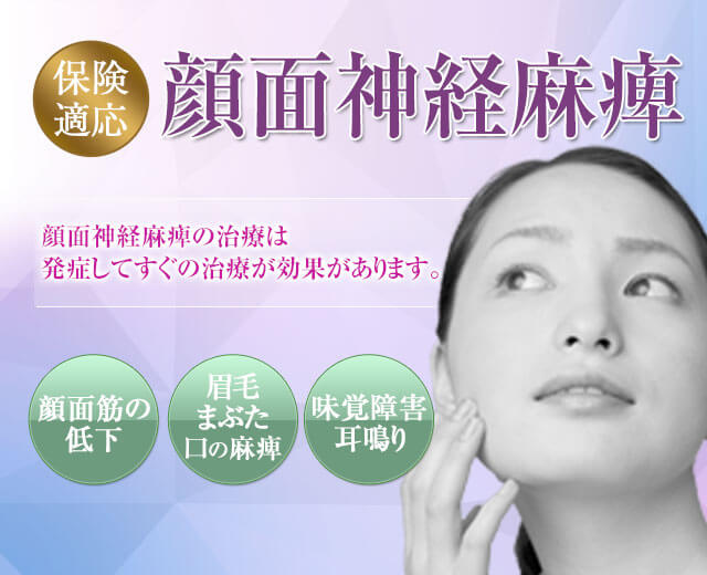 顔面神経麻痺